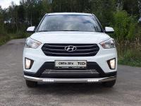 Hyundai Creta (15–) Защита передняя нижняя (овальная с ДХО) 75х42 мм