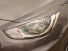 Hyundai Solaris (10 – 13) реснички на фары №2 фигурные